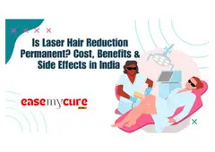 Get Smooth Skin with Laser Hair Removal in Delhi | Book at EaseMyCure